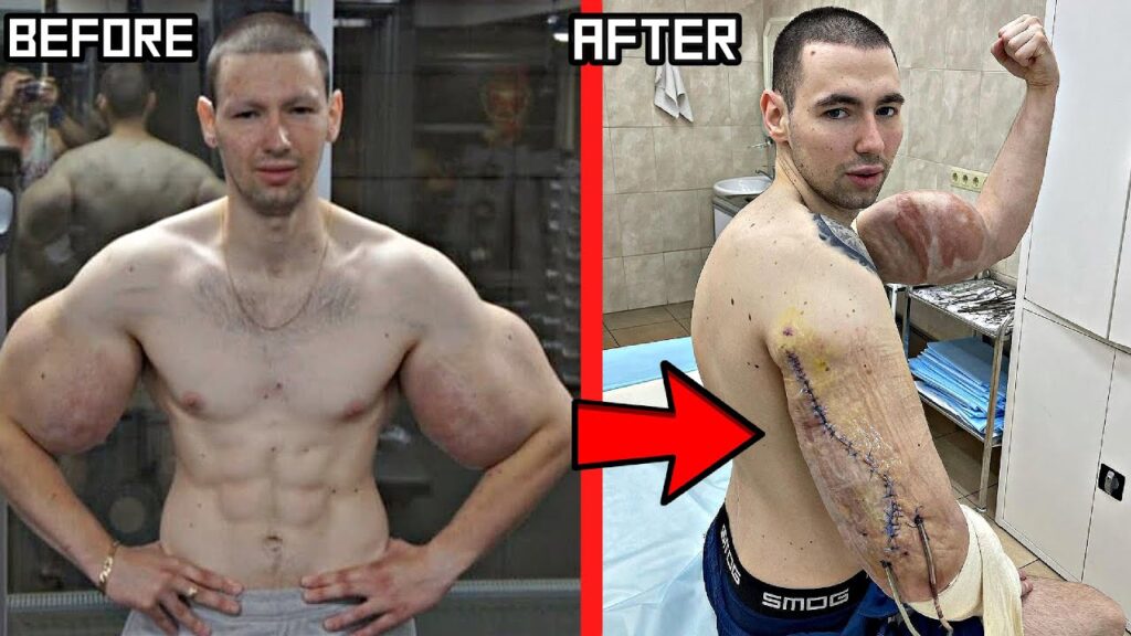 antes e depois de popeye russo