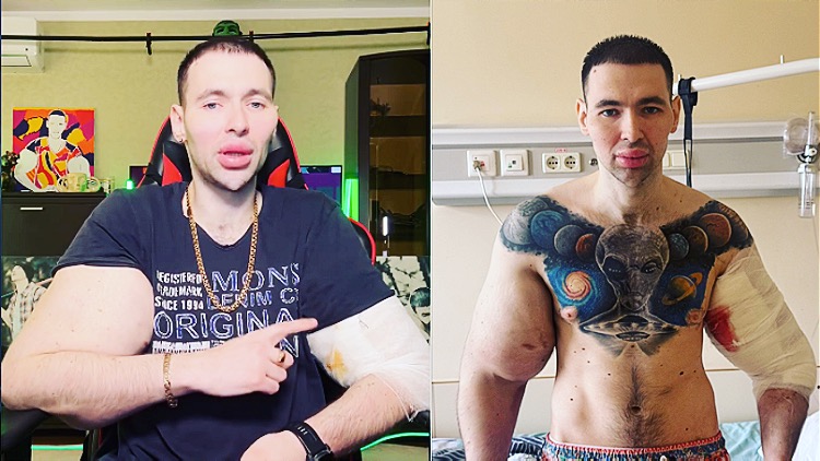 médicos sobre popeye russo